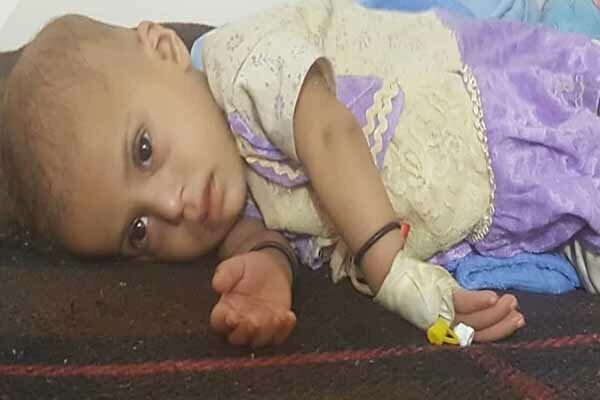 ۸۰ درصد از یمنی‌ها برای زنده ماندن به کمک نیاز دارند