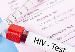 مرکز تحقیقات ایدز: ۵۵ هزار نفر مبتلا به اچ. آی. وی در کشور داریم/ ۲۳ هزار نفر از این تعداد، از بیماری خود بی خبر هستند