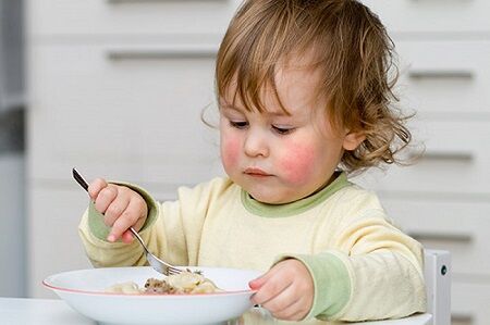 آیا آلرژی غذایی کودکان جدی است؟
